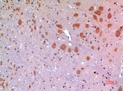 Fig.4. Immunohistochemical analysis of paraffin-embedded rat-brain, antibody was diluted at 1:100.