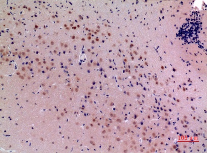 Fig.6. Immunohistochemical analysis of paraffin-embedded Mouse-brain, antibody was diluted at 1:100.