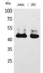 Fig.1. Western Blot analysis of Jurkat, 293 cells using SCCA1/2 Polyclonal Antibody. Secondary antibody (catalog#: A21020) was diluted at 1:20000.