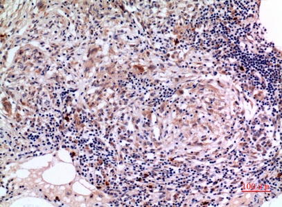 Fig.4. Immunohistochemical analysis of paraffin-embedded human-lung, antibody was diluted at 1:100.