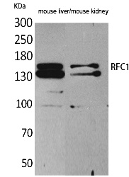 Fig. Western Blot analysis of Mouse liver, Mouse kidney cells using RFC1 Polyclonal Antibody. Secondary antibody (catalog#: A21020) was diluted at 1:20000.