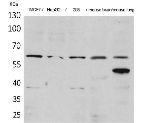 Fig.1. Western Blot analysis of MCF7, HepG2,  293, Mouse brain, Mouse lung cells using ZKSCAN4 Polyclonal Antibody. Secondary antibody (catalog#: A21020) was diluted at 1:20000.