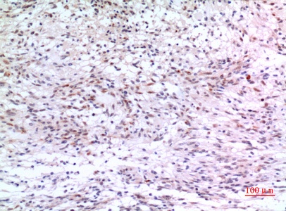 Fig.2. Immunohistochemical analysis of paraffin-embedded human-brain, antibody was diluted at 1:100.