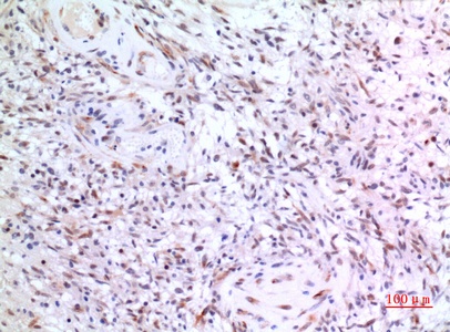 Fig.3. Immunohistochemical analysis of paraffin-embedded human-brain, antibody was diluted at 1:100.