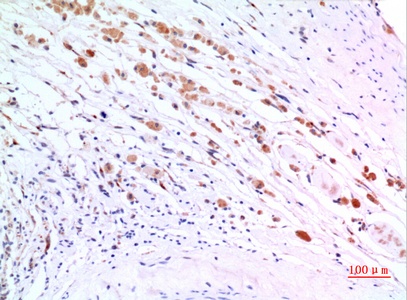 Fig.4. Immunohistochemical analysis of paraffin-embedded human-brain, antibody was diluted at 1:100.