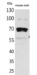 Fig.1. Western Blot analysis of Mouse brain cells using Amphiphysin II Polyclonal Antibody. Secondary antibody (catalog#: A21020) was diluted at 1:20000.