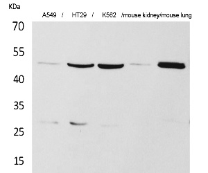 Fig.1. Western Blot analysis of A549, HT29, K562,  Mouse kidney, Mouse lung cells using GDI-2 Polyclonal Antibody. Secondary antibody (catalog#: A21020) was diluted at 1:20000.