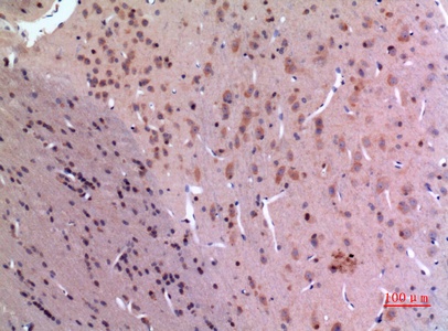 Fig.4. Immunohistochemical analysis of paraffin-embedded rat-brain, antibody was diluted at 1:100.