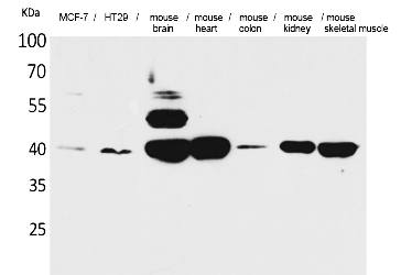 Fig.1. Western Blot analysis of MCF-7, HT29, Mouse brain, Mouse heart, Mouse colon, Mouse kidney, Mouse skeletal muscle cells using IDH3A Polyclonal Antibody. Secondary antibody (catalog#: A21020) was diluted at 1:20000.
