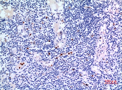 Fig.3. Immunohistochemical analysis of paraffin-embedded human-lymph-gland, antibody was diluted at 1:100.