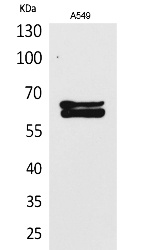 Fig. Western Blot analysis of A549 cells using NUMB Polyclonal Antibody. Secondary antibody (catalog#: A21020) was diluted at 1:20000.