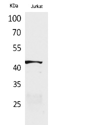 Fig.1. Western Blot analysis of Jurkat cells using E2F-4 Polyclonal Antibody. Secondary antibody (catalog#: A21020) was diluted at 1:20000.