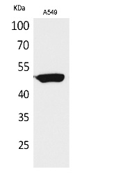 Fig. Western Blot analysis of A549 cells using HNF-3α/β/γ Polyclonal Antibody. Secondary antibody (catalog#: A21020) was diluted at 1:20000.