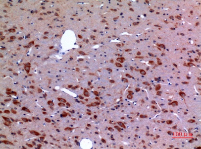 Fig.2. Immunohistochemical analysis of paraffin-embedded rat-brain, antibody was diluted at 1:100.