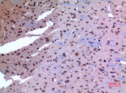 Fig.3. Immunohistochemical analysis of paraffin-embedded rat-brain, antibody was diluted at 1:100.