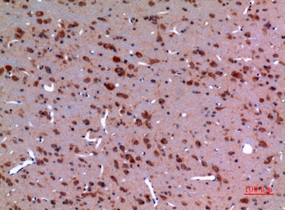 Fig.4. Immunohistochemical analysis of paraffin-embedded rat-brain, antibody was diluted at 1:100.