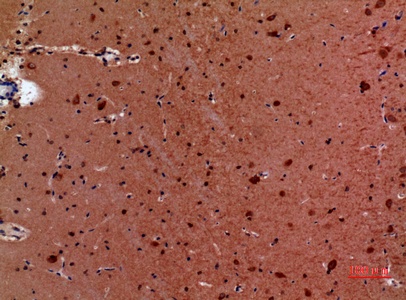 Fig.5. Immunohistochemical analysis of paraffin-embedded Mouse-brain, antibody was diluted at 1:100.