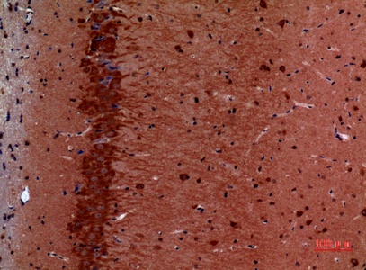 Fig.6. Immunohistochemical analysis of paraffin-embedded Mouse-brain, antibody was diluted at 1:100.