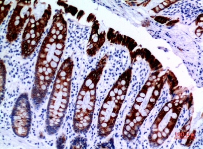 Fig.2. Immunohistochemical analysis of paraffin-embedded human-colon, antibody was diluted at 1:100.