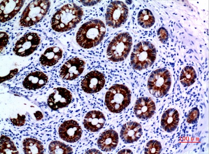 Fig.3. Immunohistochemical analysis of paraffin-embedded human-colon, antibody was diluted at 1:100.