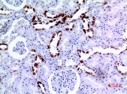 Fig.4. Immunohistochemical analysis of paraffin-embedded human-kidney, antibody was diluted at 1:100.