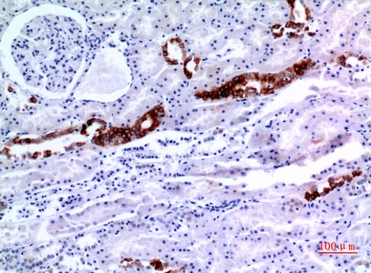 Fig.5. Immunohistochemical analysis of paraffin-embedded human-kidney, antibody was diluted at 1:100.