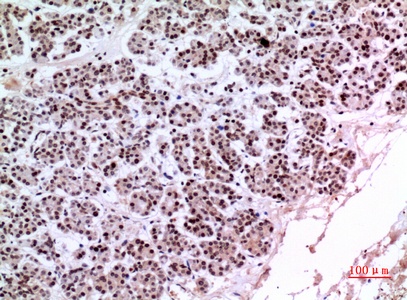 Fig.3. Immunohistochemical analysis of paraffin-embedded human-pancreas, antibody was diluted at 1:100.