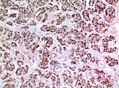 Fig.4. Immunohistochemical analysis of paraffin-embedded human-pancreas, antibody was diluted at 1:100.