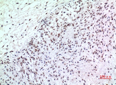 Fig.5. Immunohistochemical analysis of paraffin-embedded human-brain, antibody was diluted at 1:100.