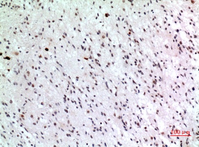 Fig.6. Immunohistochemical analysis of paraffin-embedded human-brain, antibody was diluted at 1:100.