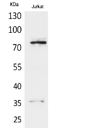 Fig.1. Western Blot analysis of Jurkat cells using p73 Polyclonal Antibody. Secondary antibody (catalog#: A21020) was diluted at 1:20000.