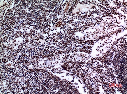 Fig.2. Immunohistochemical analysis of paraffin-embedded human-lymph-gland, antibody was diluted at 1:100.