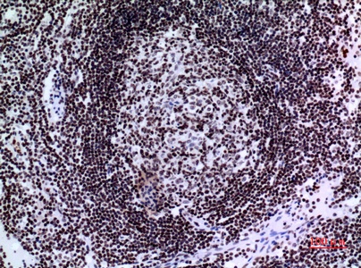 Fig.3. Immunohistochemical analysis of paraffin-embedded human-lymph-gland, antibody was diluted at 1:100.
