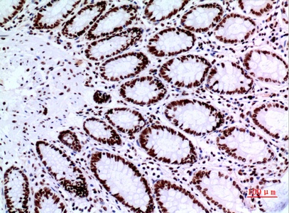 Fig.4. Immunohistochemical analysis of paraffin-embedded human-colon, antibody was diluted at 1:100.