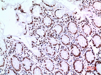 Fig.5. Immunohistochemical analysis of paraffin-embedded human-colon, antibody was diluted at 1:100.