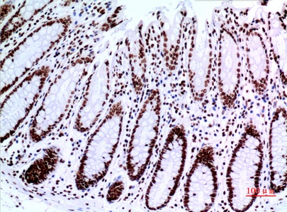 Fig.6. Immunohistochemical analysis of paraffin-embedded human-colon, antibody was diluted at 1:100.