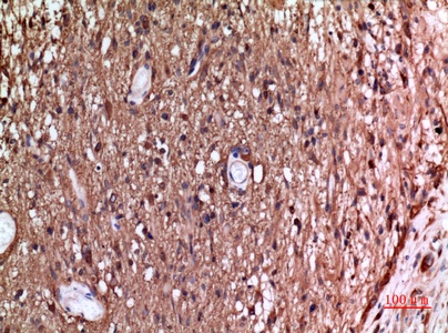 Fig.2. Immunohistochemical analysis of paraffin-embedded human-brain, antibody was diluted at 1:100.