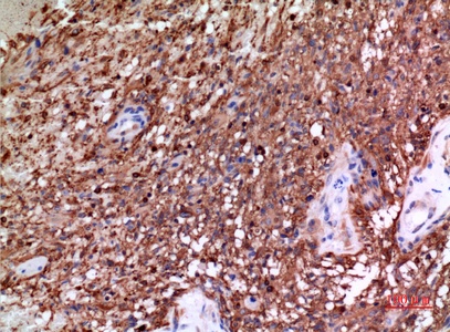 Fig.3. Immunohistochemical analysis of paraffin-embedded human-brain, antibody was diluted at 1:100.