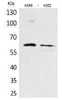 Fig. Western Blot analysis of A549, K562 cells using Smad1 Polyclonal Antibody. Secondary antibody (catalog#: A21020) was diluted at 1:20000.