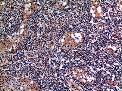 Fig.2. Immunohistochemical analysis of paraffin-embedded human-lymph-gland, antibody was diluted at 1:100.