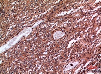 Fig.3. Immunohistochemical analysis of paraffin-embedded human-brain, antibody was diluted at 1:100.