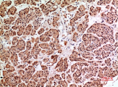 Fig.2. Immunohistochemical analysis of paraffin-embedded human-pancreas, antibody was diluted at 1:100.