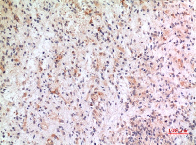 Fig.2. Immunohistochemical analysis of paraffin-embedded human-brain, antibody was diluted at 1:100.