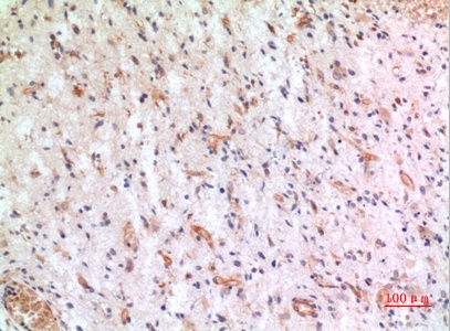 Fig.4. Immunohistochemical analysis of paraffin-embedded human-brain, antibody was diluted at 1:100.