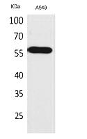 Fig.1. Western Blot analysis of A549 cells using ALDH2 Polyclonal Antibody. Secondary antibody (catalog#: A21020) was diluted at 1:20000.