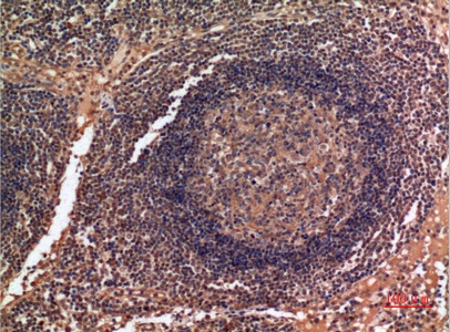 Fig.2. Immunohistochemical analysis of paraffin-embedded human-lymph-gland, antibody was diluted at 1:100.