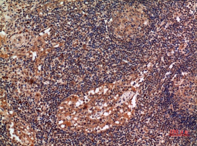 Fig.3. Immunohistochemical analysis of paraffin-embedded human-lymph-gland, antibody was diluted at 1:100.