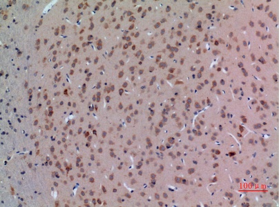 Fig.2. Immunohistochemical analysis of paraffin-embedded rat-brain, antibody was diluted at 1:100.