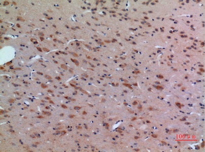 Fig.3. Immunohistochemical analysis of paraffin-embedded rat-brain, antibody was diluted at 1:100.