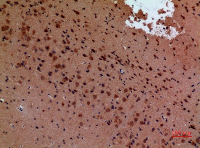 Fig.4. Immunohistochemical analysis of paraffin-embedded Mouse-brain, antibody was diluted at 1:100.